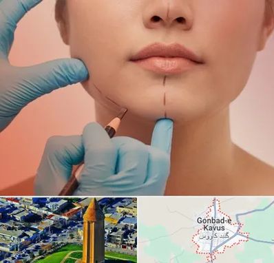 دکتر زیبایی خانم در گنبد کاووس