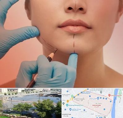 دکتر زیبایی خانم در گلستان اهواز 