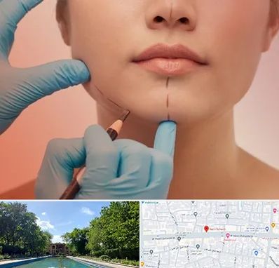 دکتر زیبایی خانم در هشت بهشت اصفهان 