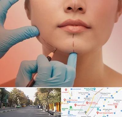 دکتر زیبایی خانم در شریعتی 