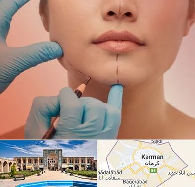 دکتر زیبایی خانم در کرمان