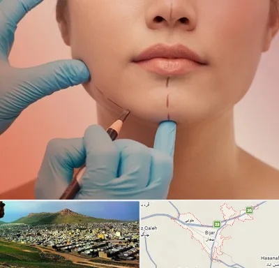 دکتر زیبایی خانم در بیجار