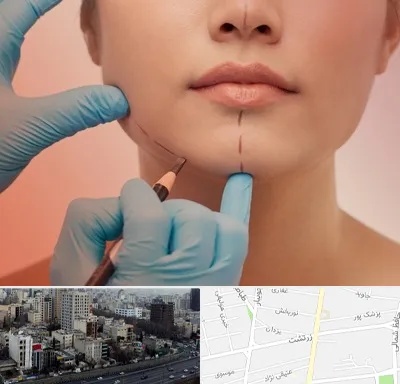 دکتر زیبایی خانم در زرتشت