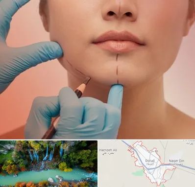 دکتر زیبایی خانم در دورود