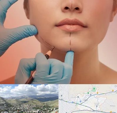 دکتر زیبایی خانم در رودهن