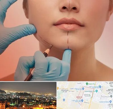 دکتر زیبایی خانم در مارلیک کرج 