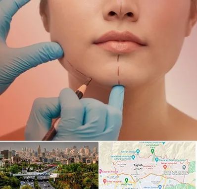 دکتر زیبایی خانم در منطقه 1 تهران 