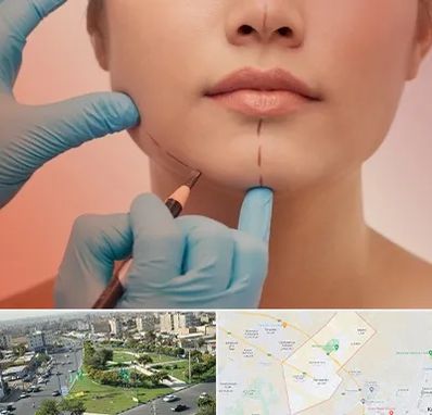 دکتر زیبایی خانم در کمال شهر کرج 