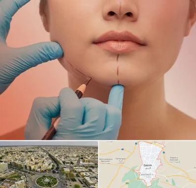 دکتر زیبایی خانم در قزوین