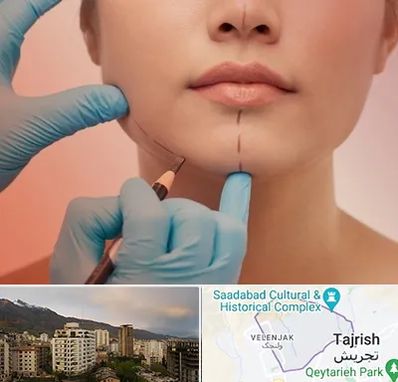 دکتر زیبایی خانم در زعفرانیه 