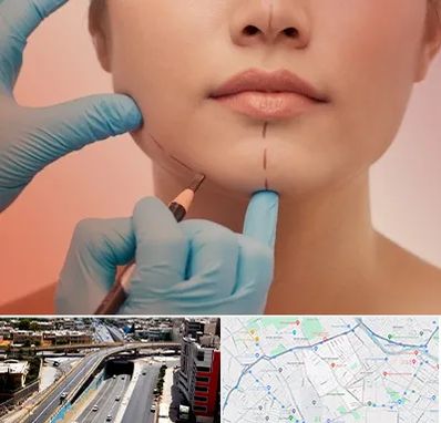 دکتر زیبایی خانم در ستارخان شیراز 