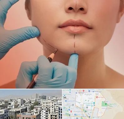 دکتر زیبایی خانم در منطقه 14 تهران 