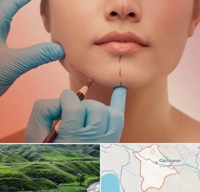 دکتر زیبایی خانم در گچساران