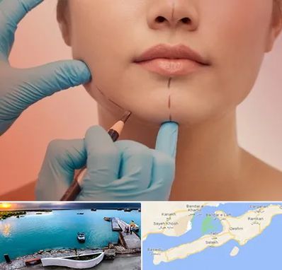 دکتر زیبایی خانم در قشم