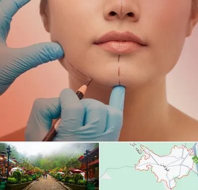 دکتر زیبایی خانم در فومن