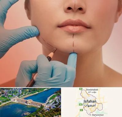 دکتر زیبایی خانم در اصفهان