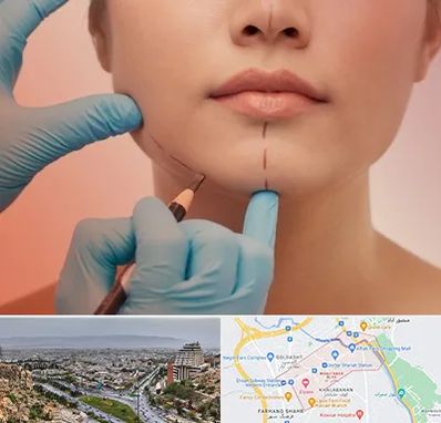 دکتر زیبایی خانم در معالی آباد شیراز 