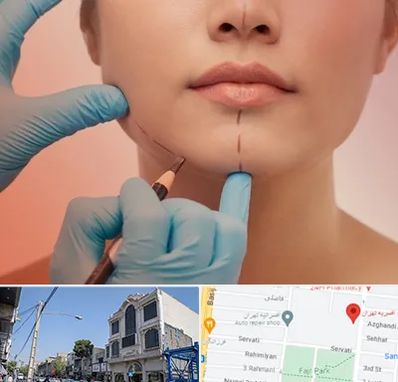 دکتر زیبایی خانم در افسریه 