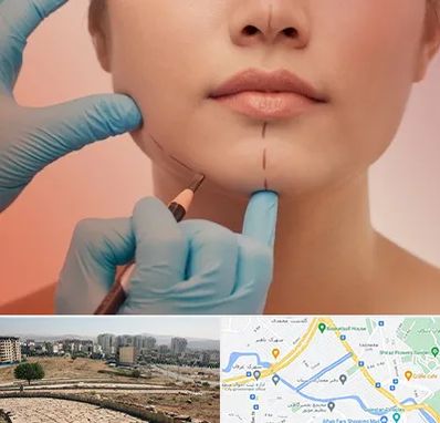 دکتر زیبایی خانم در کوی وحدت شیراز 