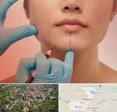 دکتر زیبایی خانم در دماوند