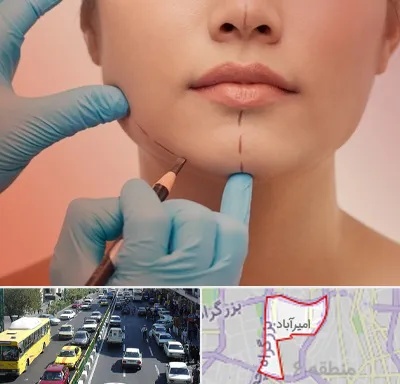 دکتر زیبایی خانم در امیرآباد