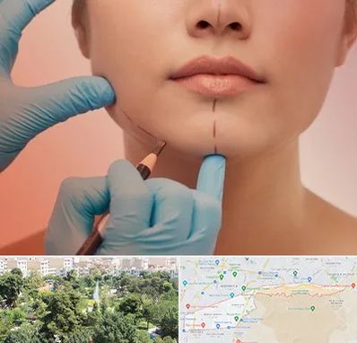 دکتر زیبایی خانم در منطقه 13 تهران 