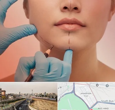 دکتر زیبایی خانم در جوادیه