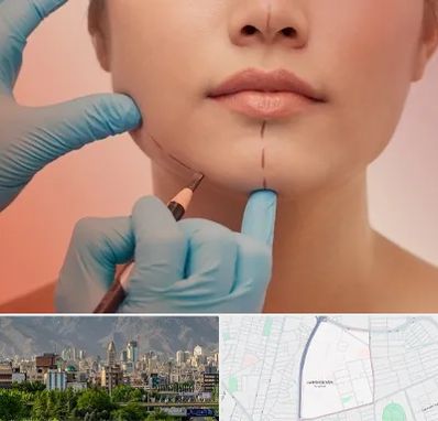 دکتر زیبایی خانم در جمشیدیه