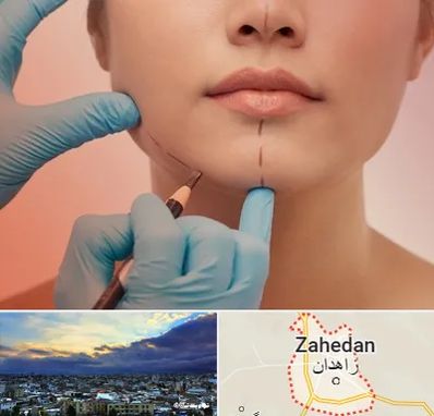 دکتر زیبایی خانم در زاهدان