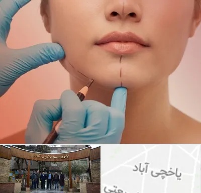 دکتر زیبایی خانم در یاخچی آباد
