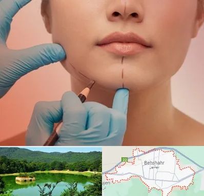 دکتر زیبایی خانم در بهشهر