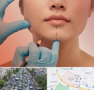 دکتر زیبایی خانم در گلشهر کرج 