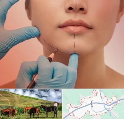 دکتر زیبایی خانم در تالش