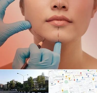 دکتر زیبایی خانم در میدان کاج 