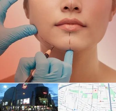 دکتر زیبایی خانم در بلوار اباذر