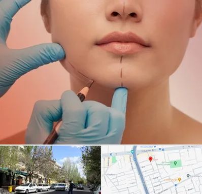 دکتر زیبایی خانم در کوی فیروز تبریز