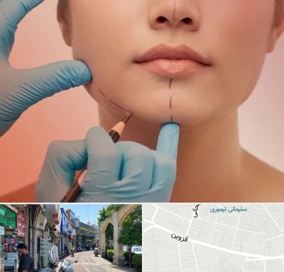 دکتر زیبایی خانم در خیابان قزوین