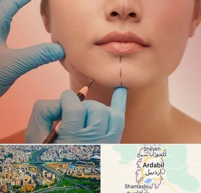 دکتر زیبایی خانم در اردبیل