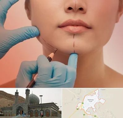 دکتر زیبایی خانم در شهرضا