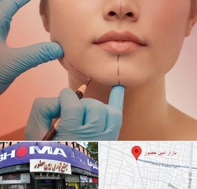 دکتر زیبایی خانم در امین حضور