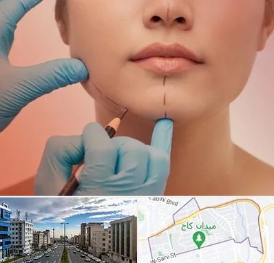 دکتر زیبایی خانم در سعادت آباد 