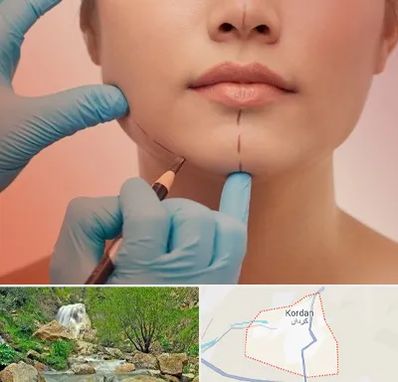 دکتر زیبایی خانم در کردان