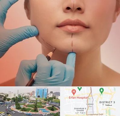 دکتر زیبایی خانم در ونک 