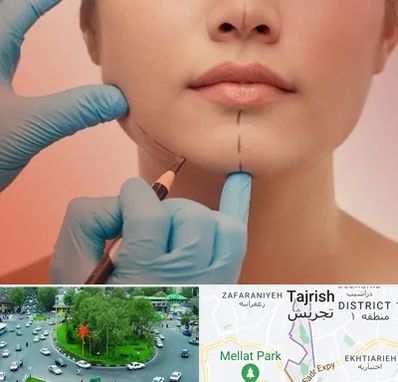 دکتر زیبایی خانم در تجریش 