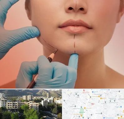 دکتر زیبایی خانم در دیباجی 