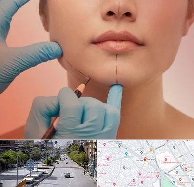 دکتر زیبایی خانم در خیابان زند شیراز 