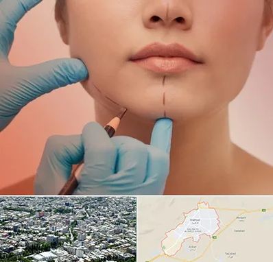 دکتر زیبایی خانم در شاهرود