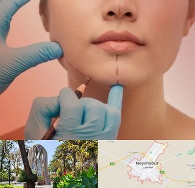 دکتر زیبایی خانم در نیشابور