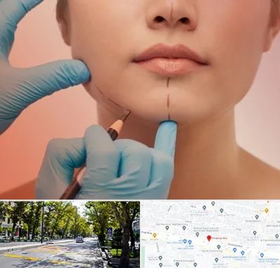 دکتر زیبایی خانم در میرداماد 