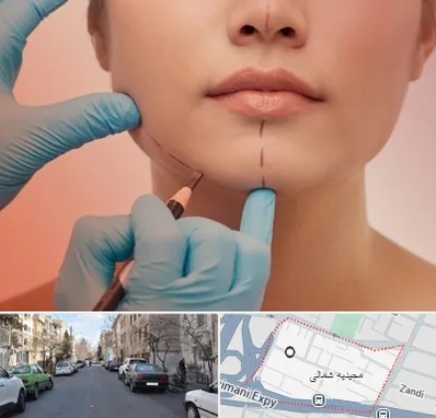 دکتر زیبایی خانم در مجیدیه شمالی